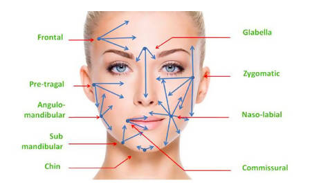 SoftFil Precision Dermal Filling Micro Cannula - Box of 20