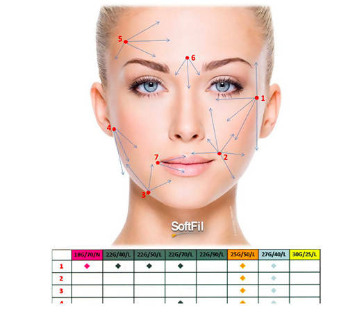 SoftFil Precision Dermal Filling Micro Cannula - Box of 20